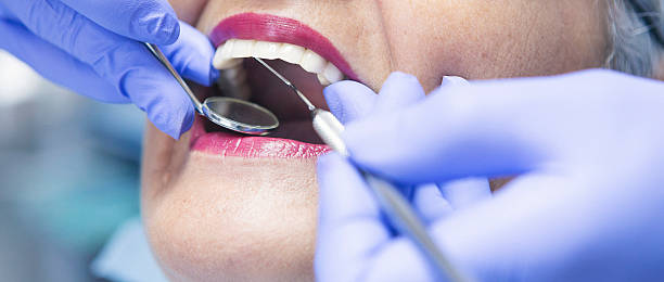 Best Emergency Treatment for Toothache in Maryland Heights, MO